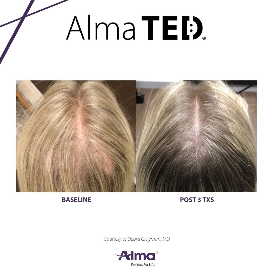 A before and after picture of a person 's hair