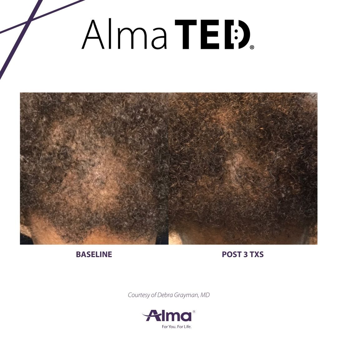 A before and after picture of a person 's hair
