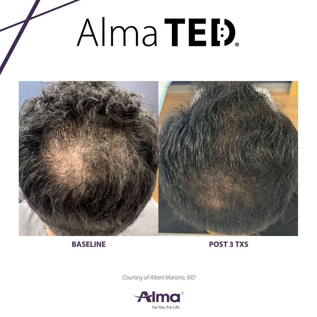 A before and after picture of a person 's hair