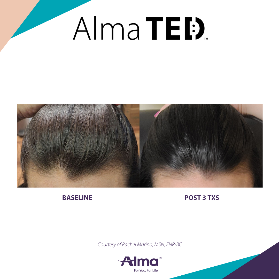 A before and after picture of a woman 's hair