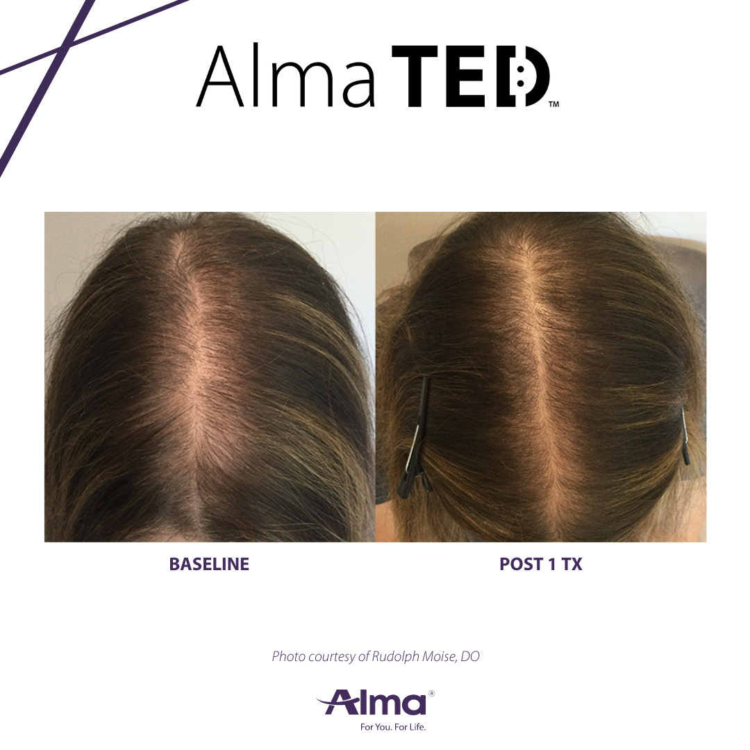 A before and after picture of a woman 's hair
