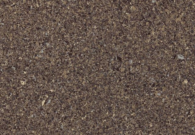 Dark brown, textured surface with small, light-colored flecks.