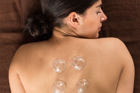 Cupping