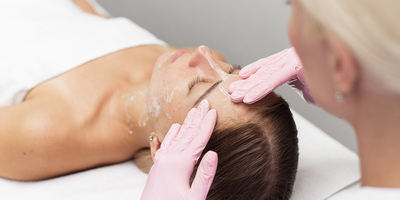 professional chemical peels