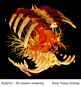 A 3d volume rendering of a skeleton with the words bone tissue setting below it.