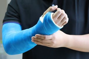 A person with a blue cast on their arm.