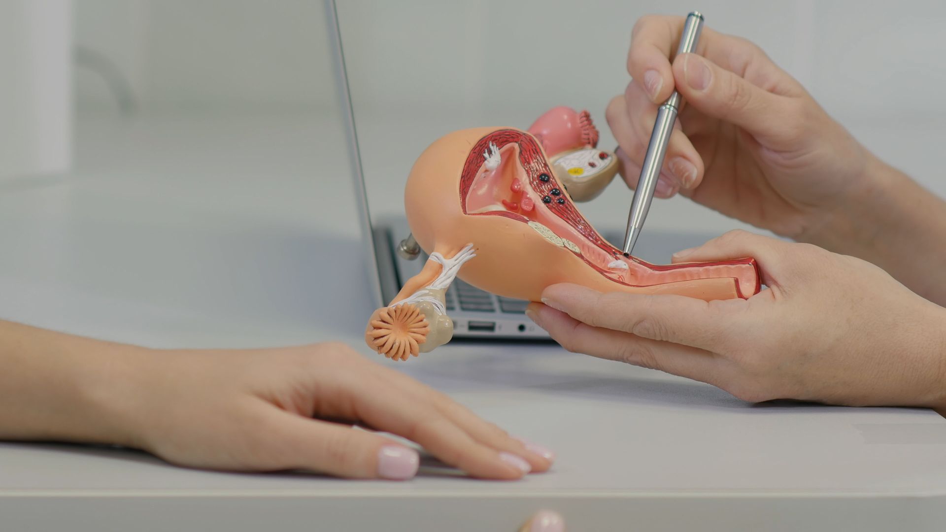 Hand demonstrating a medical model with a pen-like tool beside a patient’s arm on a desk