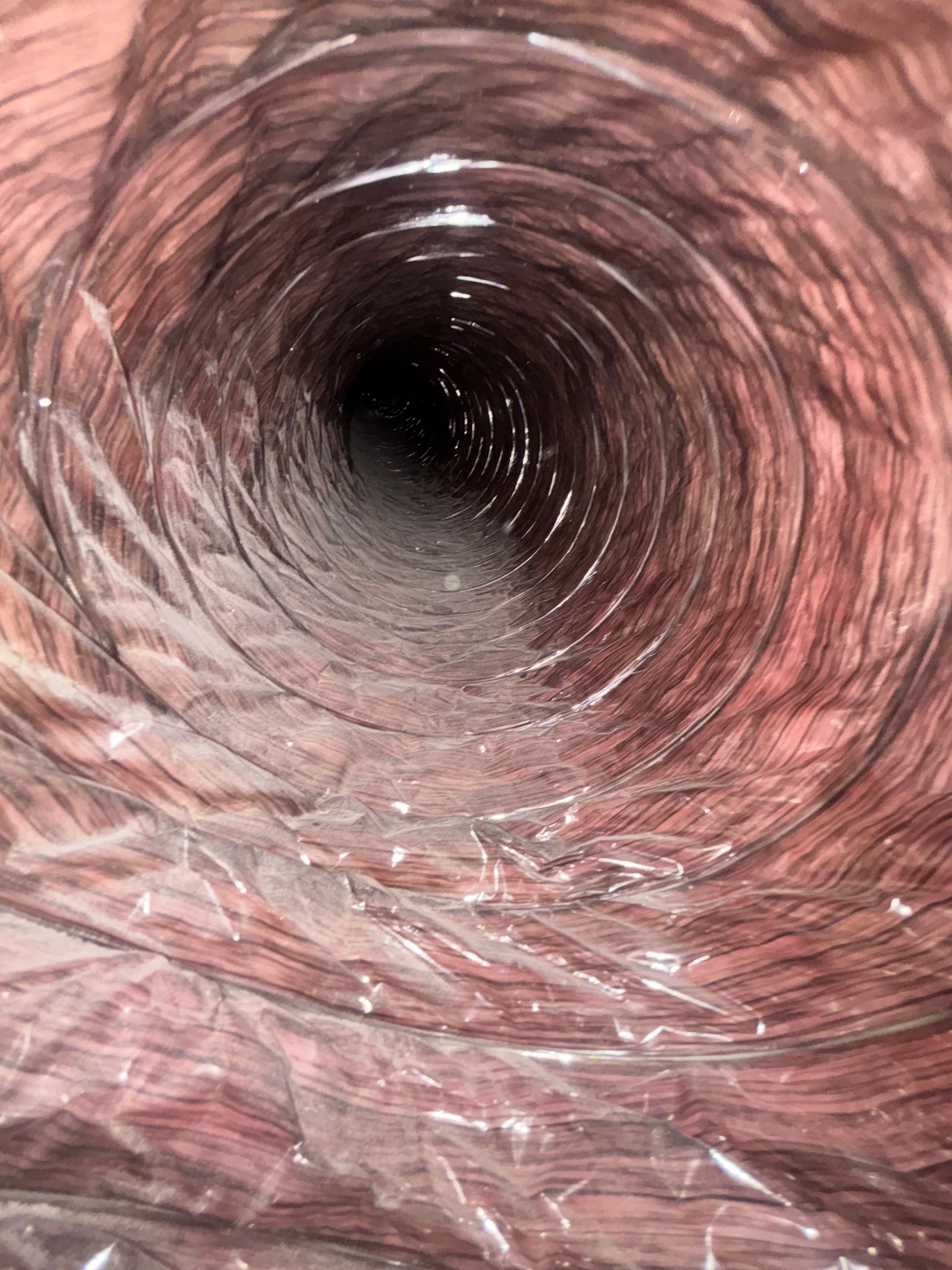 Inside of a pink, tubular passage with a dark opening at the center