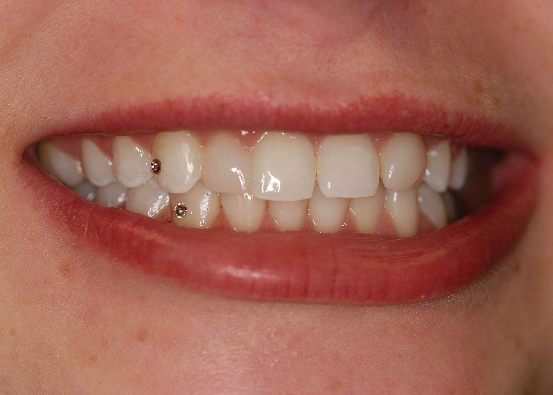 Close-up of a smiling mouth with two small metal studs on teeth; red lipstick; white teeth.