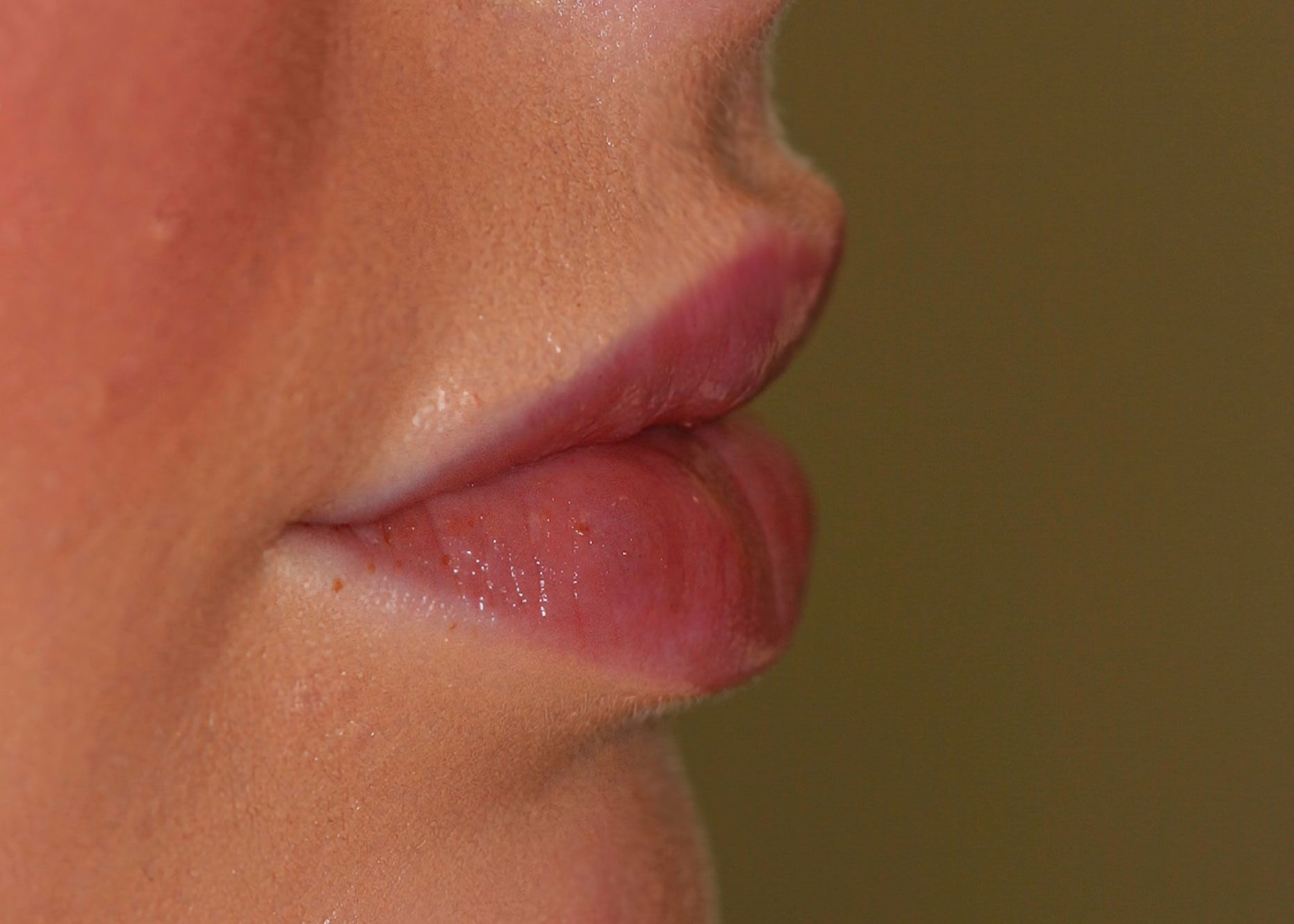Close-up of a person's side profile, showing glossy pink lips with a subtle smile.