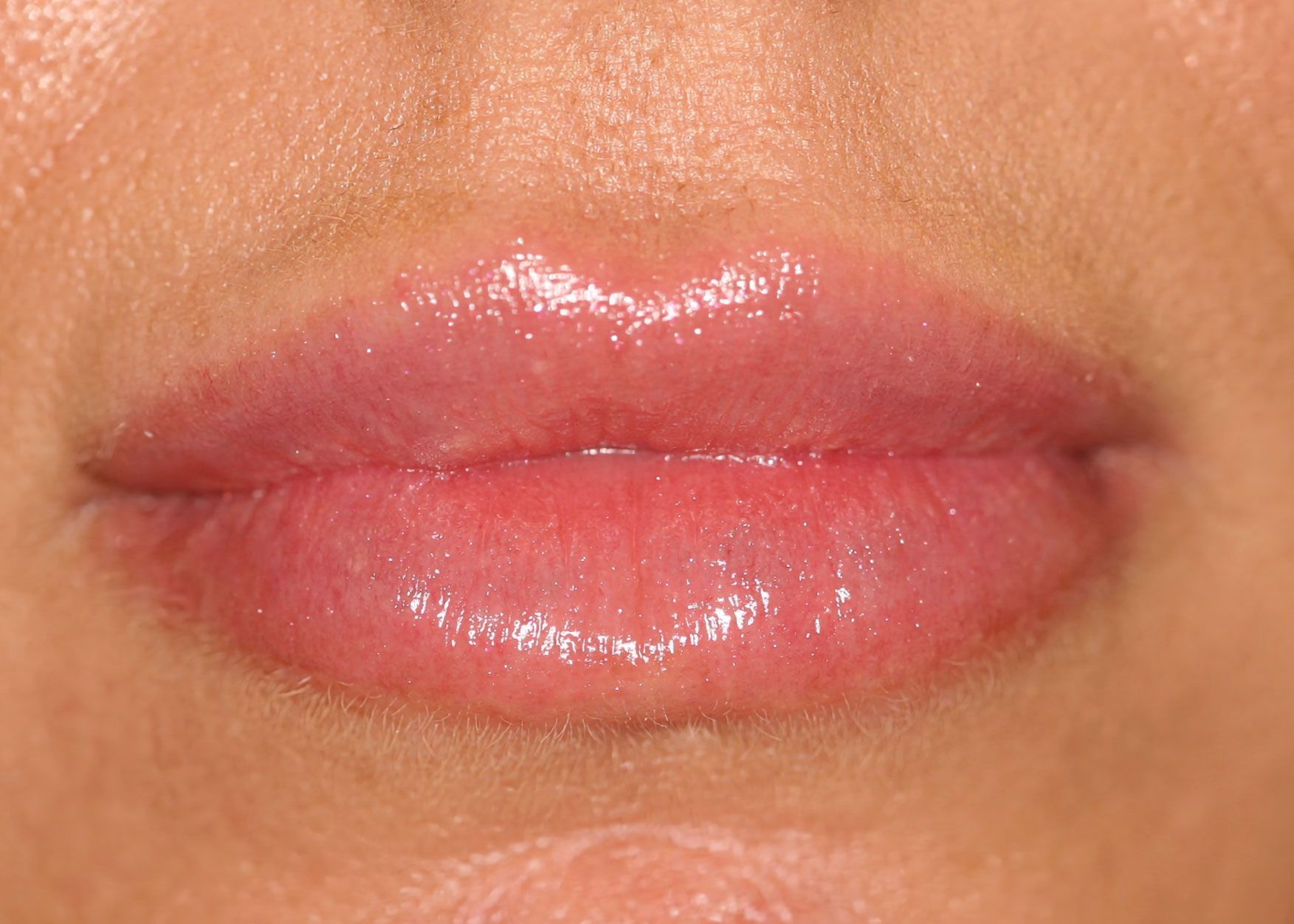 Close-up of full, glossy lips with a pinkish hue.