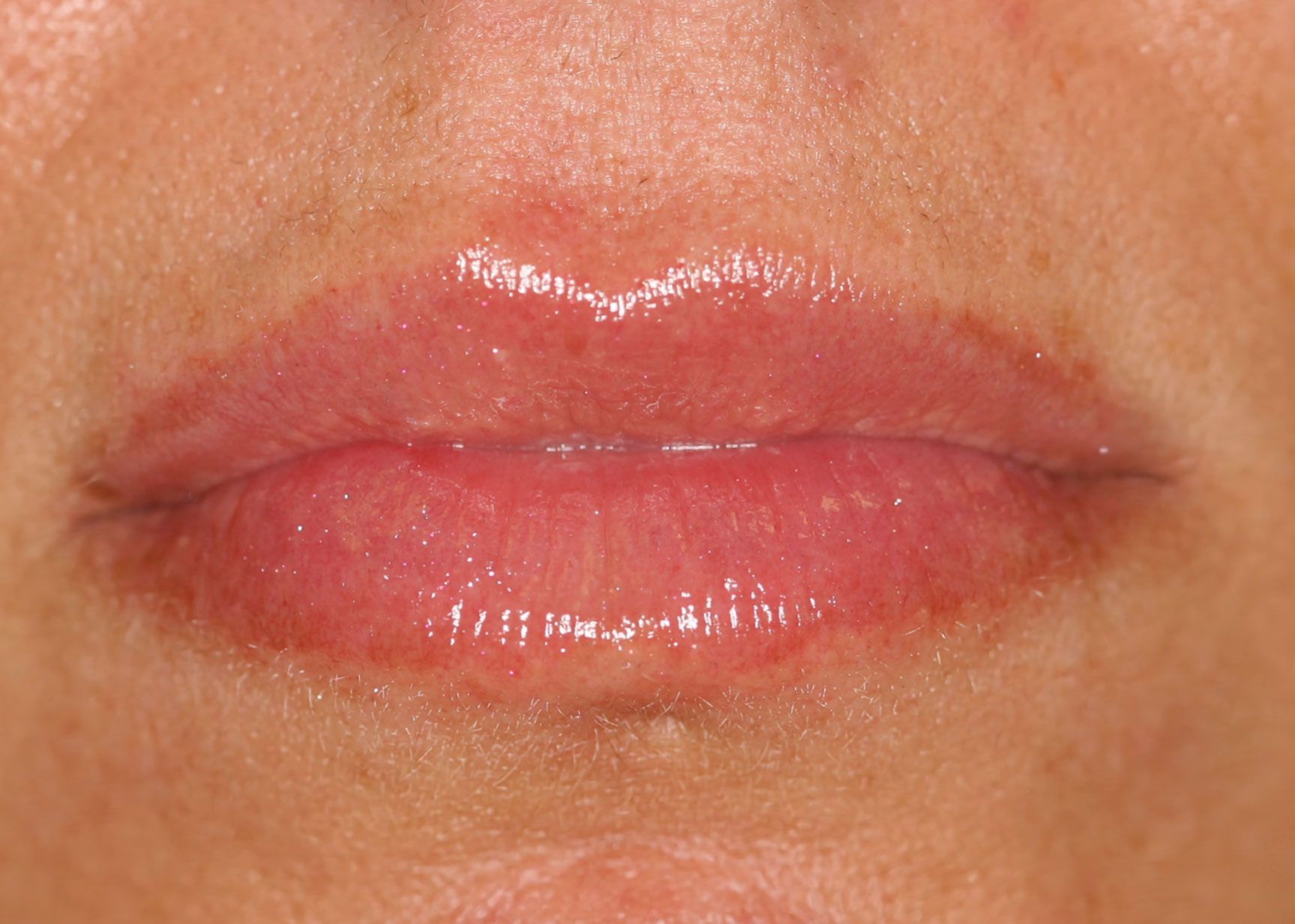 Close-up of lips, glossy pink, with a darker outline and subtle lines.