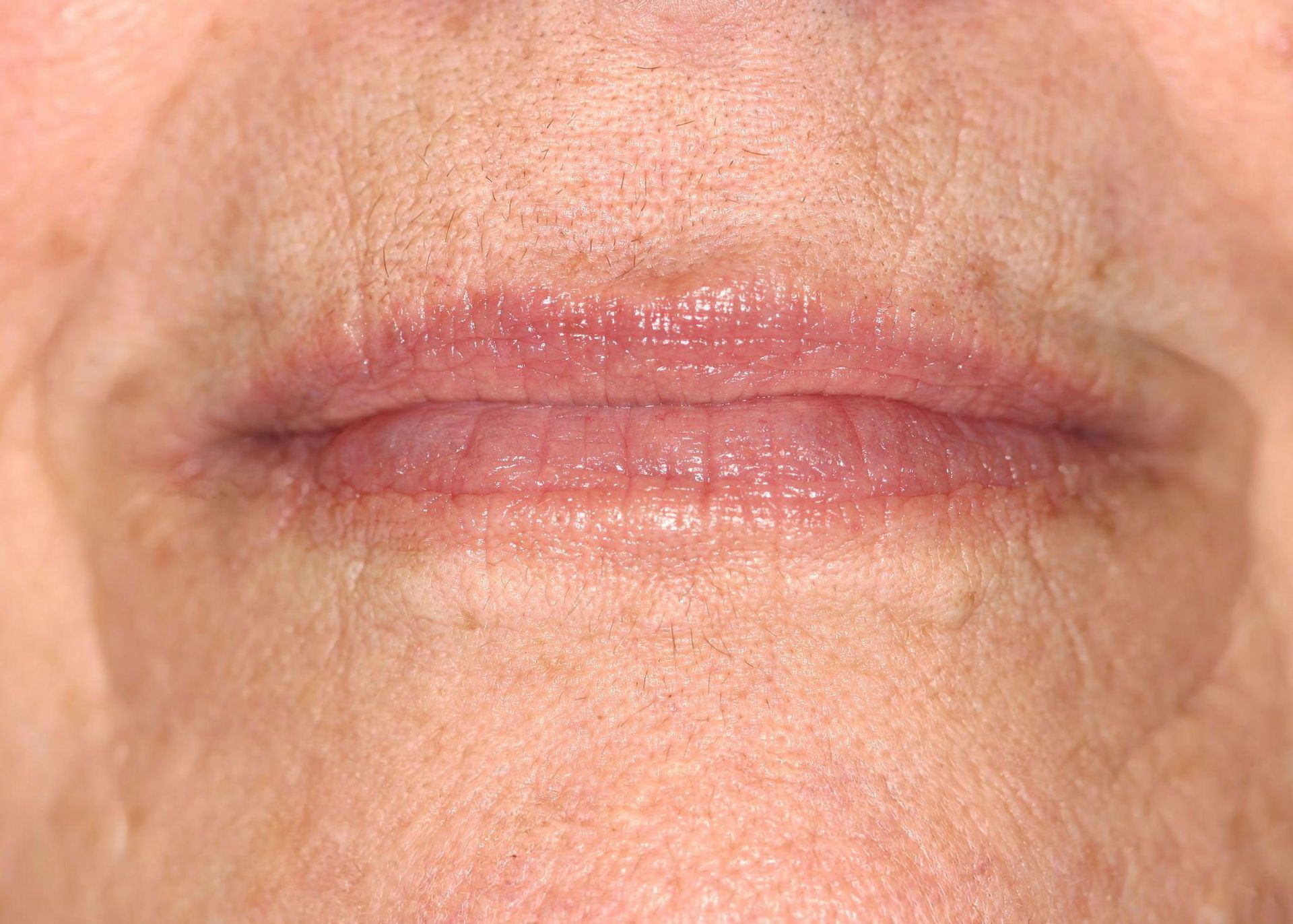 Close-up of human lips, pale pink with subtle wrinkles, on a background of light skin.
