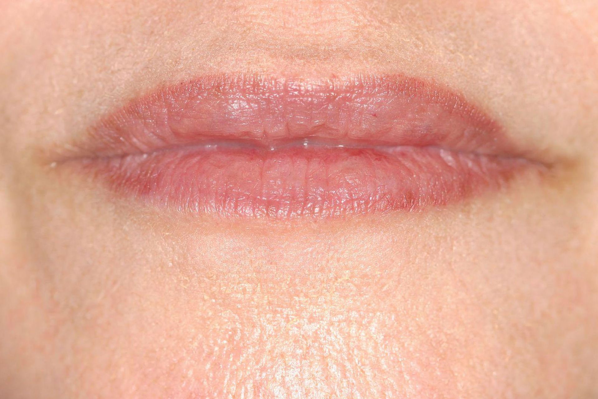 Close-up of lips, swollen and reddish, with surrounding skin showing small blemishes.
