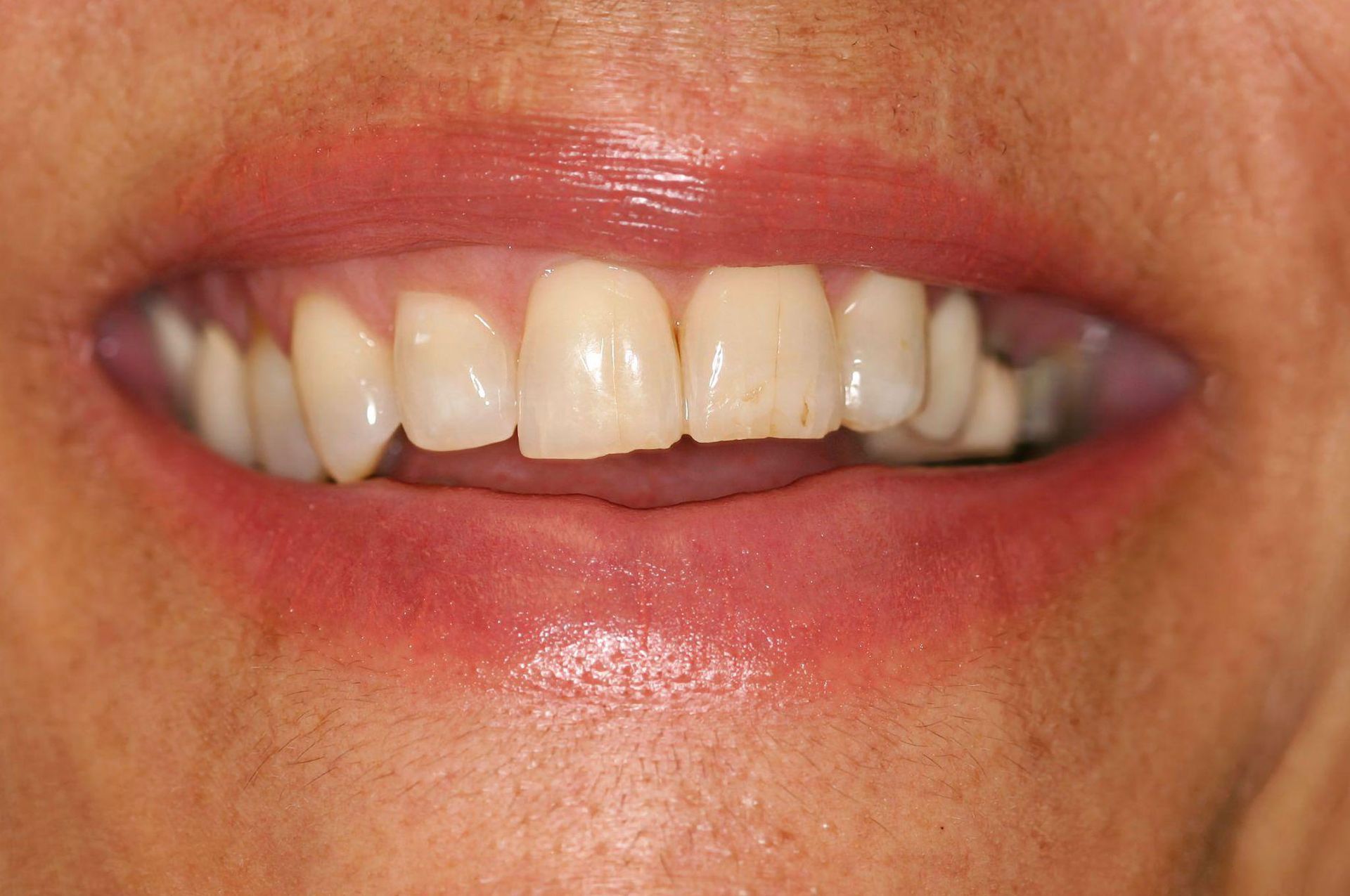 Close-up of a person's smiling mouth showing teeth, slightly parted lips, and a glimpse of the inside of the mouth.