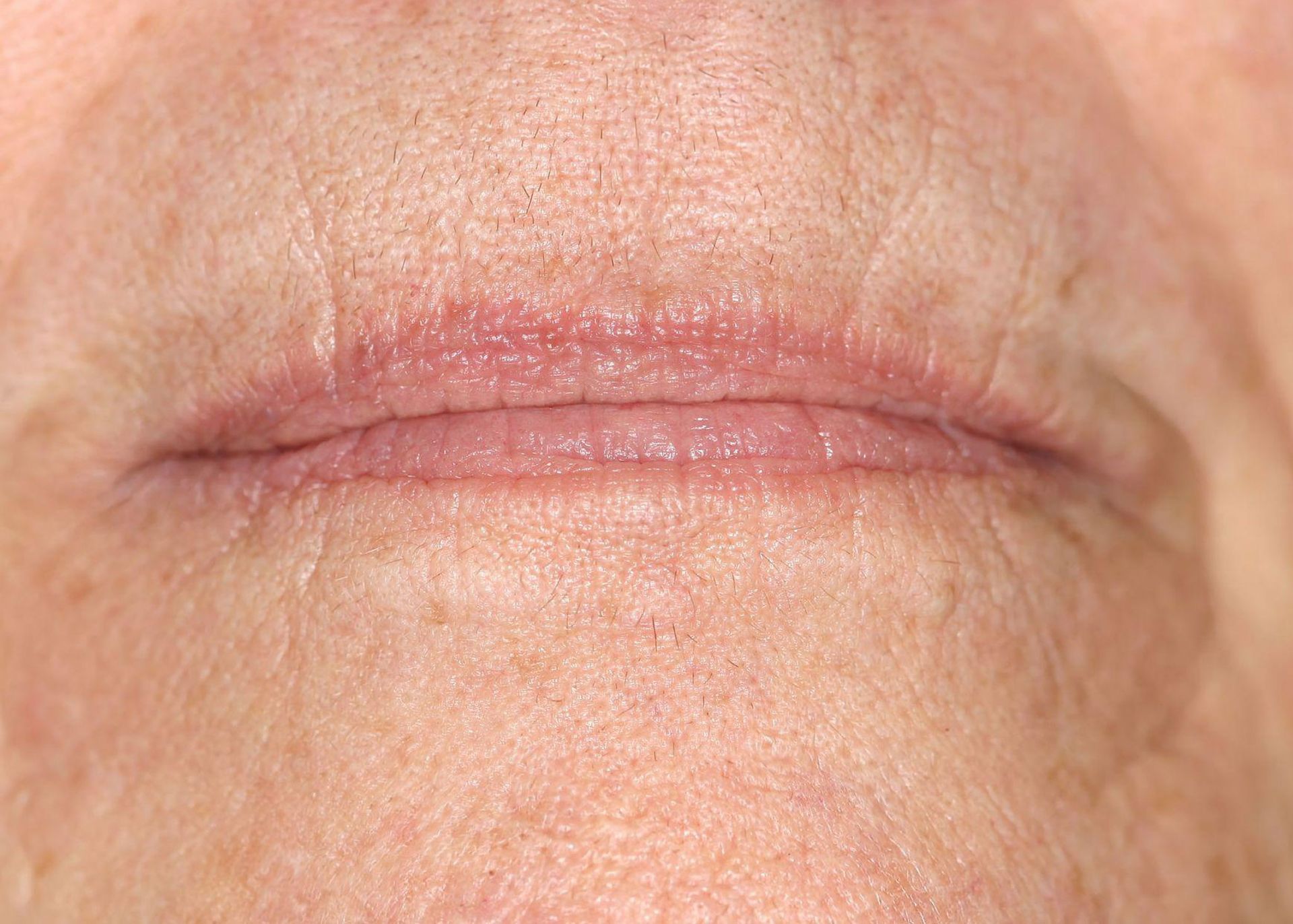 Close-up of a person's lips. Lips are slightly chapped, with fine lines around the mouth.