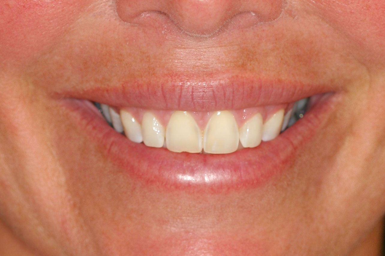 Close-up of a smiling mouth, showing even, white teeth and pink lips.