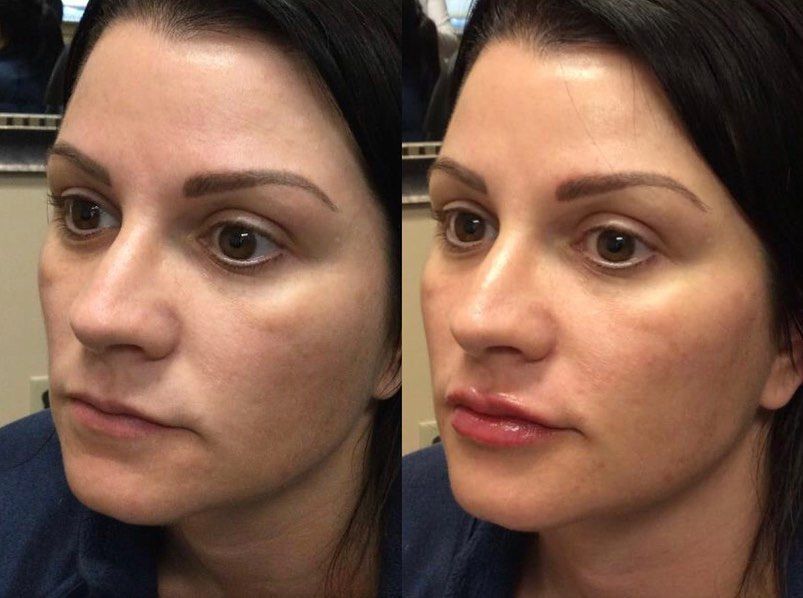A before and after photo of a woman 's face with and without makeup.