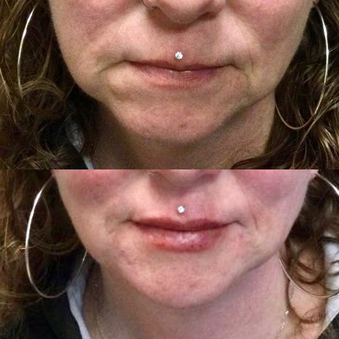 A woman with a lip piercing and hoop earrings.