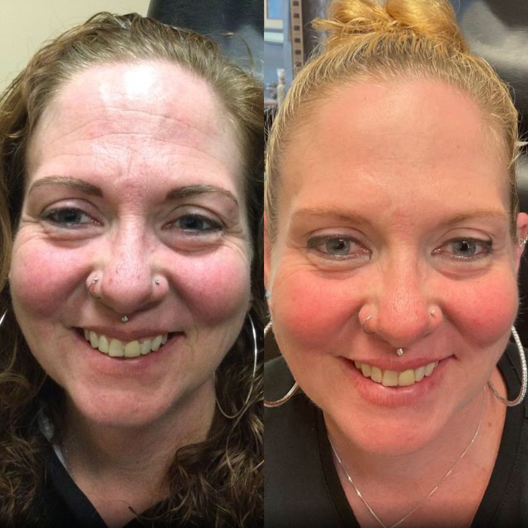 A before and after photo of a woman 's face