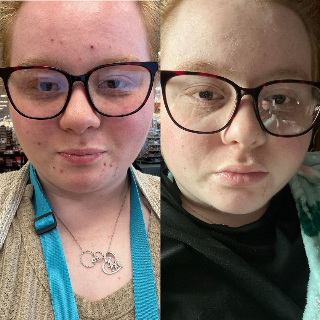 Two pictures of a woman wearing glasses and a necklace