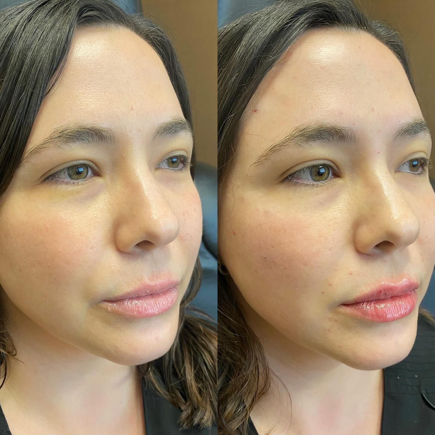 A before and after picture of a woman 's face