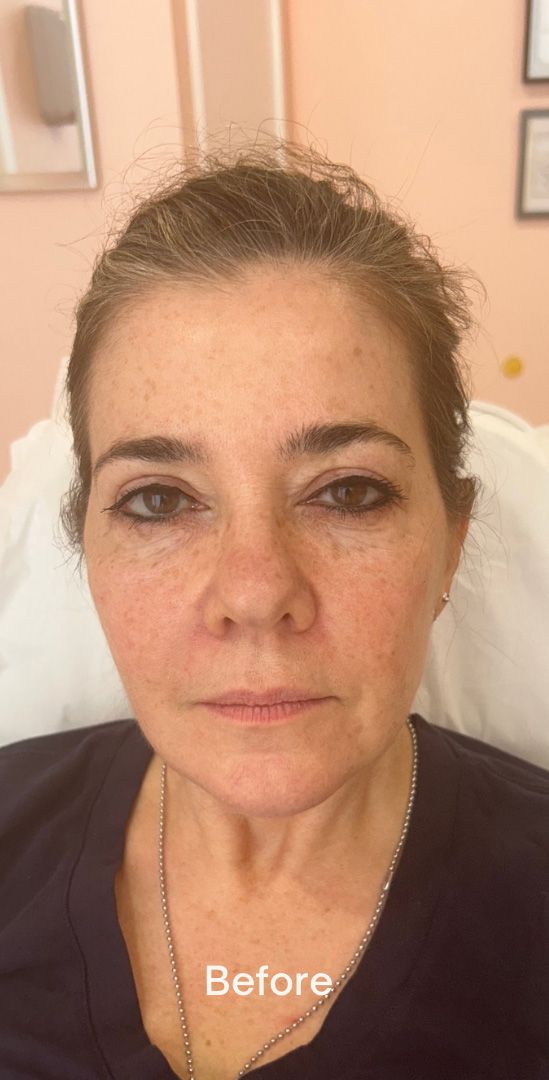 Face of a woman - before treatment