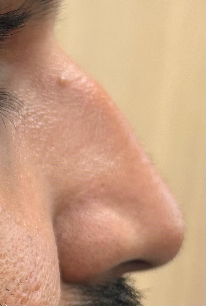 A close up of a man's nose with a beard.