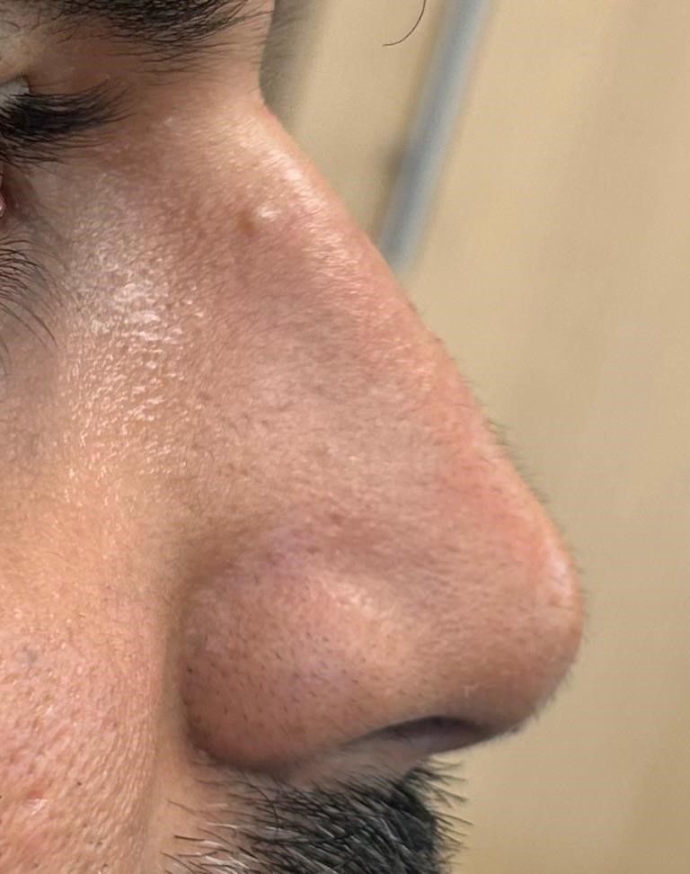 A close up of a man's nose with a beard.