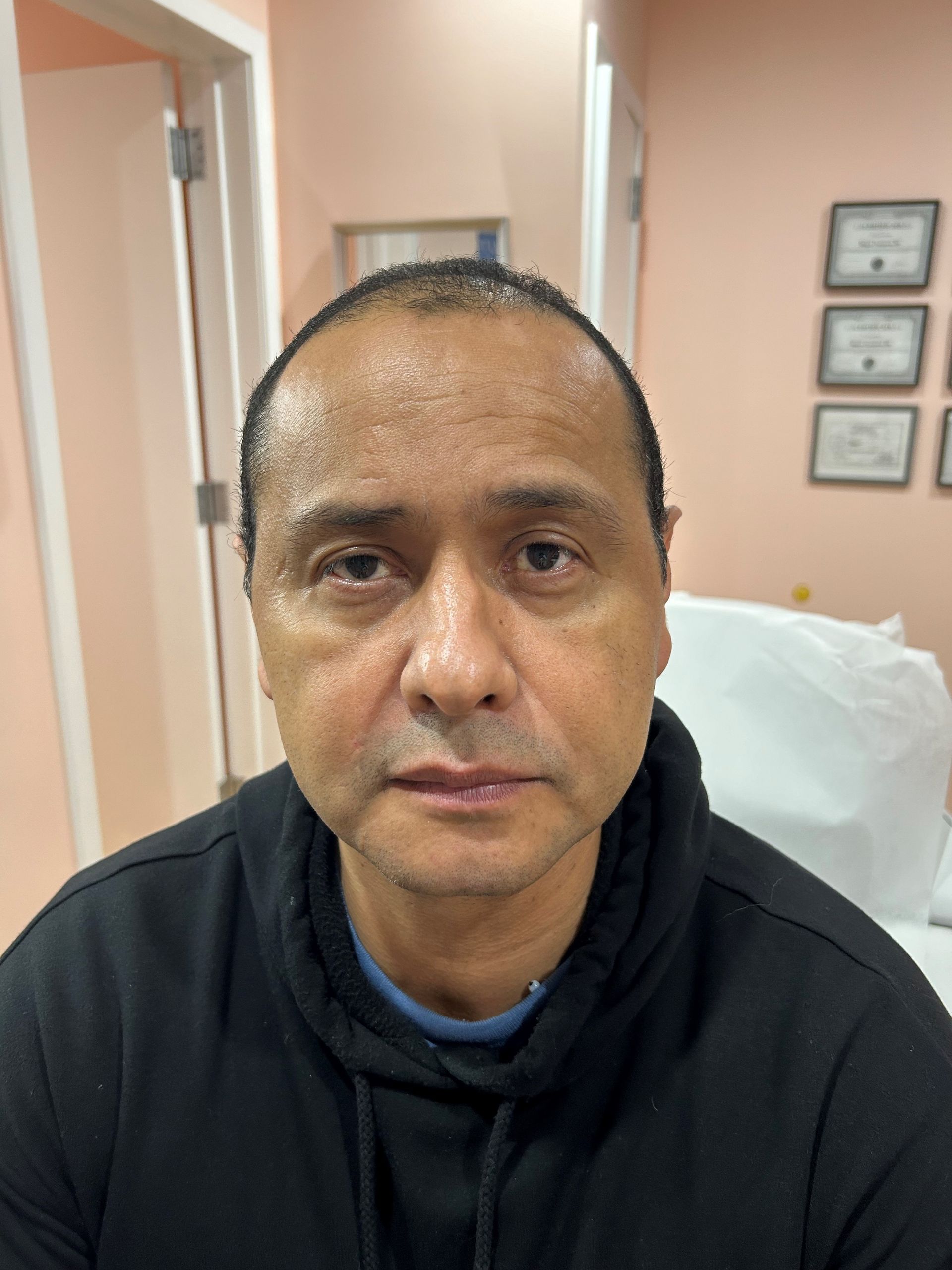 a man in a black hoodie is looking at the camera in a room with pink walls