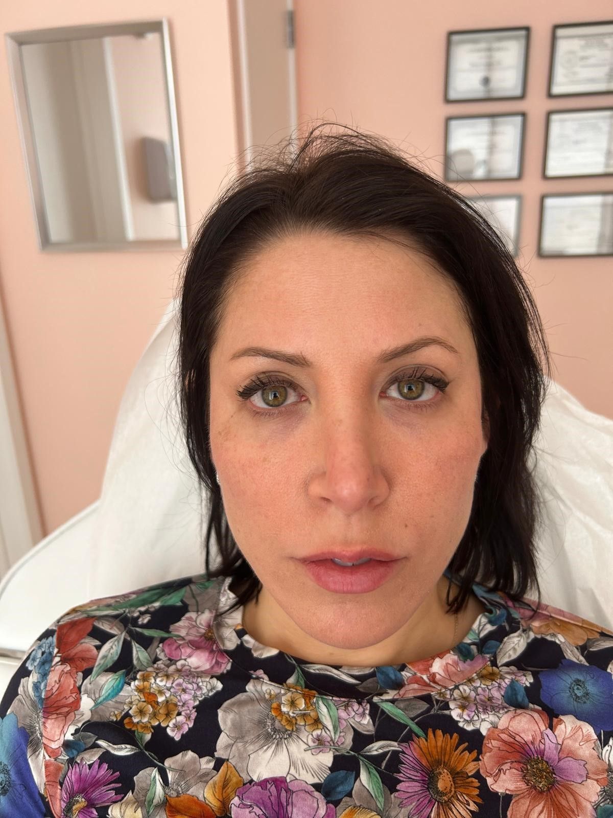 A woman in a floral shirt is sitting in a hospital bed.