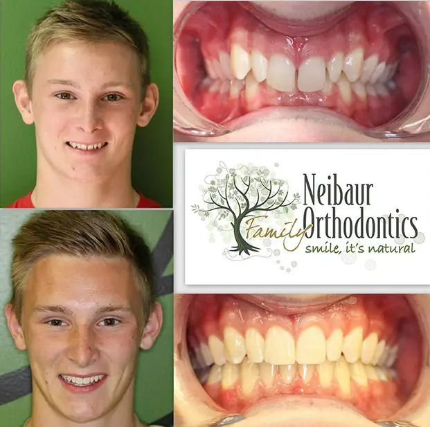 Before and after dental service