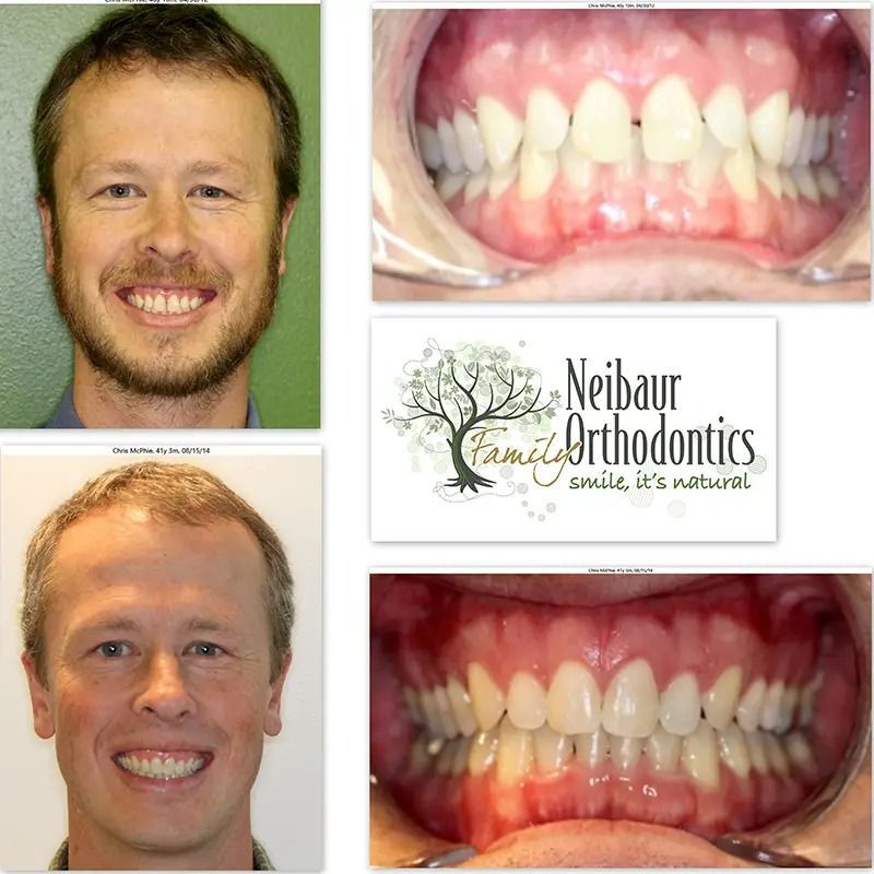 Before and after dental service