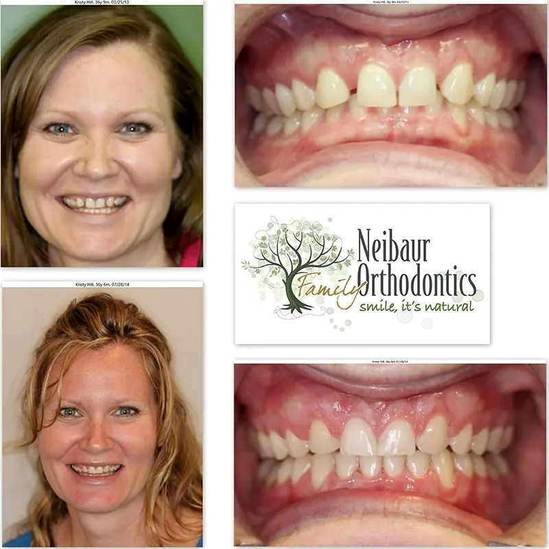 Before and after dental service