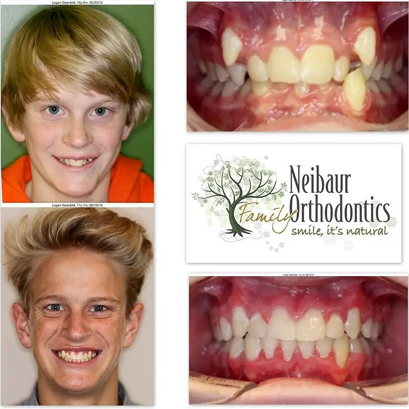 Before and after dental service