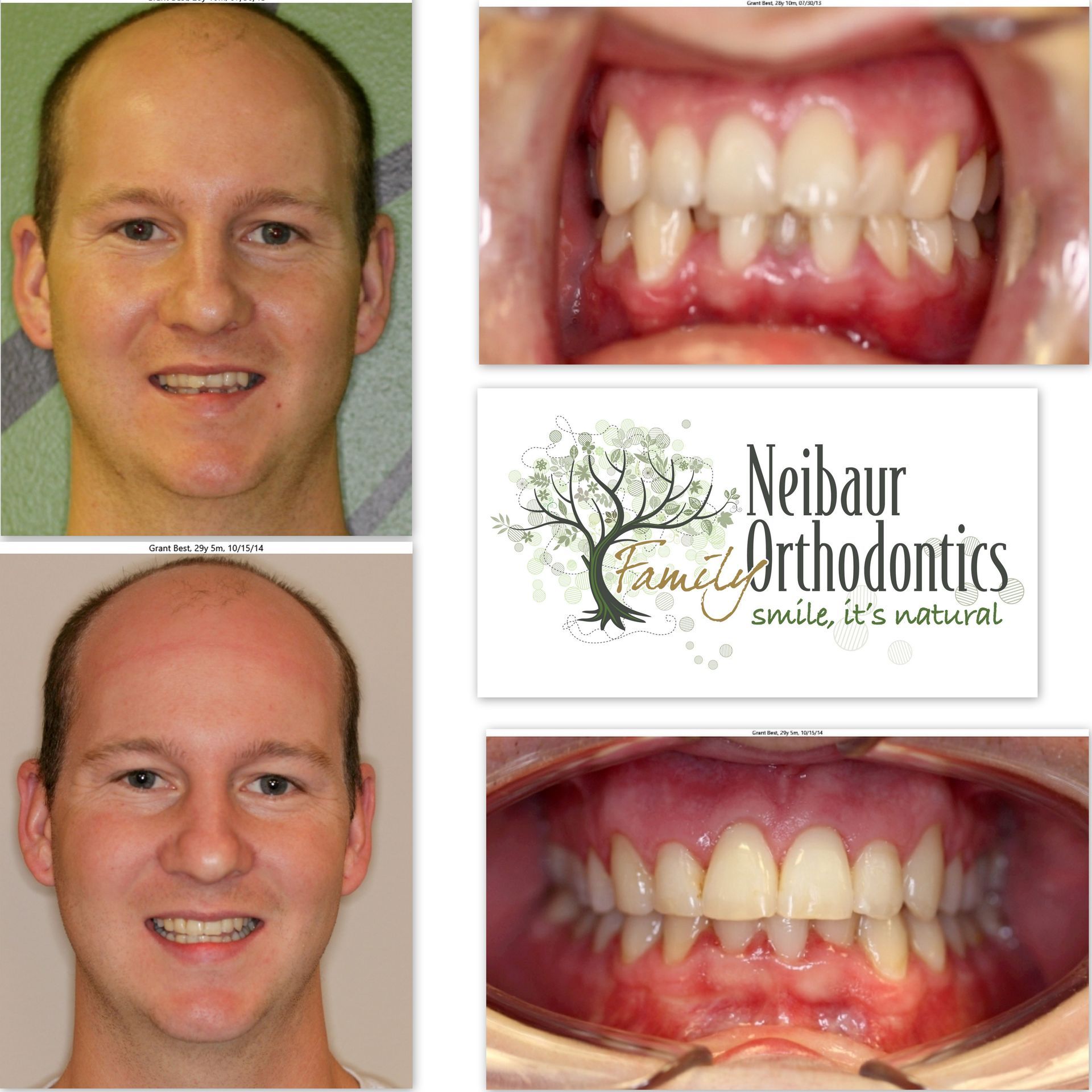 Before and after dental service