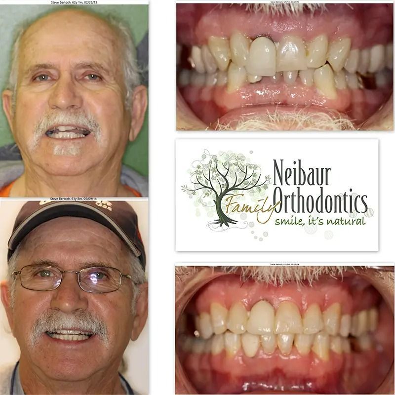 Before and after dental service