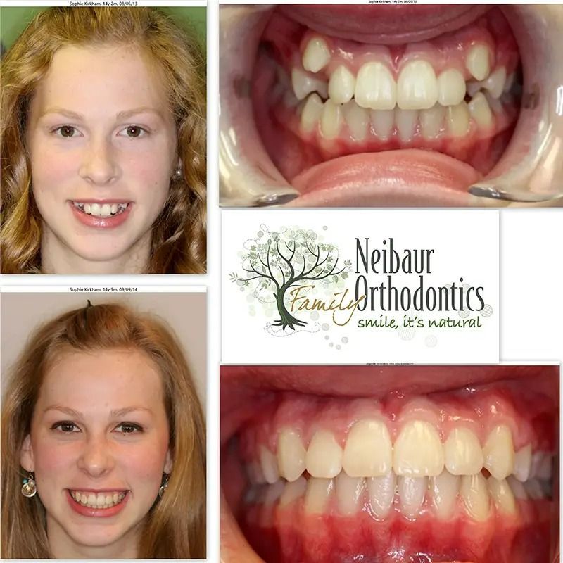 Before and after dental service