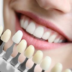 a close up of a woman 's teeth and a tooth color chart