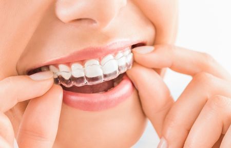 a model of a person's teeth with dental crowns on a table