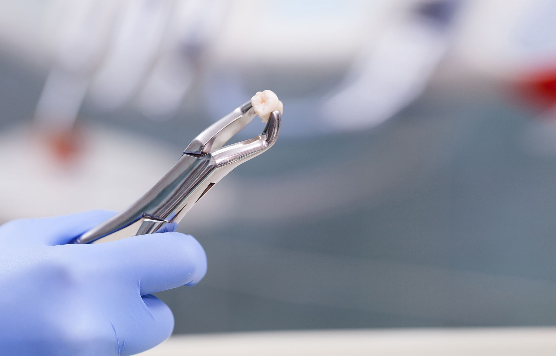 a dentist is holding a pair of dental pliers with a tooth in it