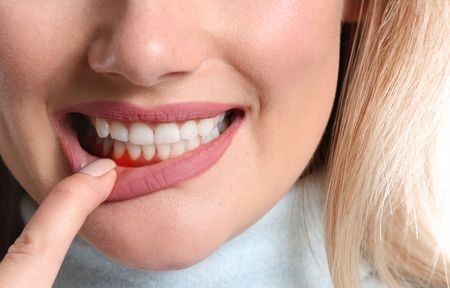 a woman is pointing at her gums with her finger