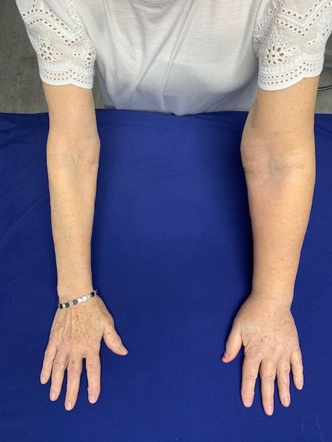 A woman 's hands are laying on a blue cloth