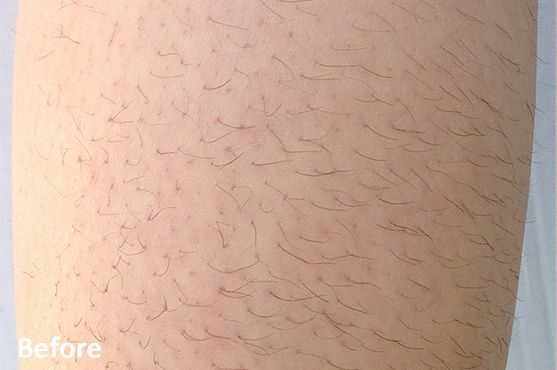 a close up of a person's leg with a lot of hair on it