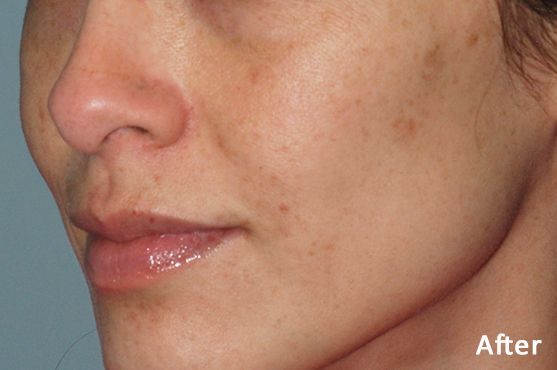 a close up of a woman's face