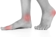 Inflamed areas on feet