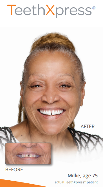 Happy elderly woman with beautiful teeth