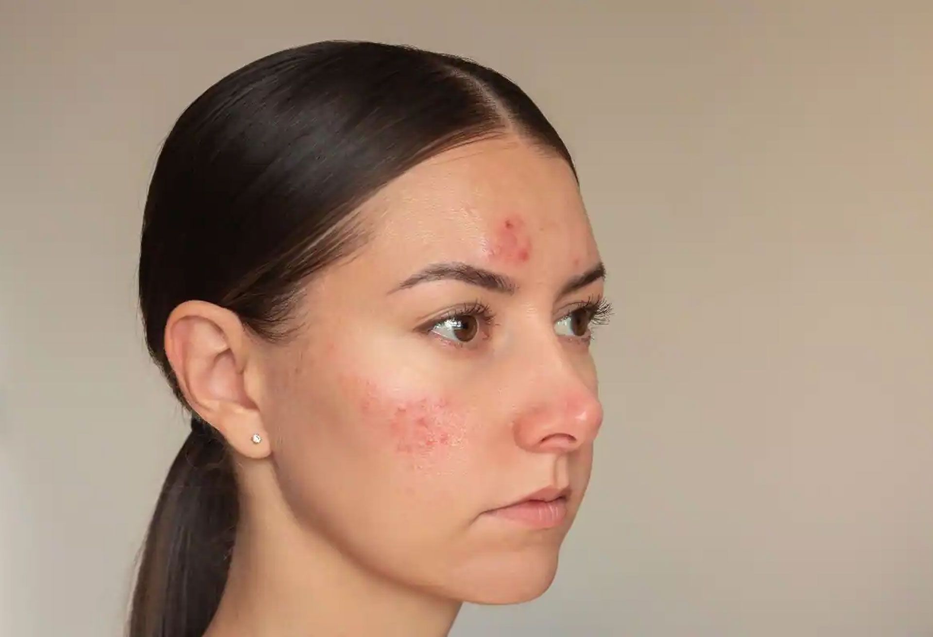 Spruce Medispa