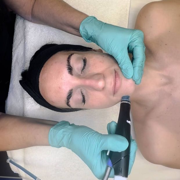 A person receiving a professional facial treatment using a handheld device on their chin while lying on a treatment bed.