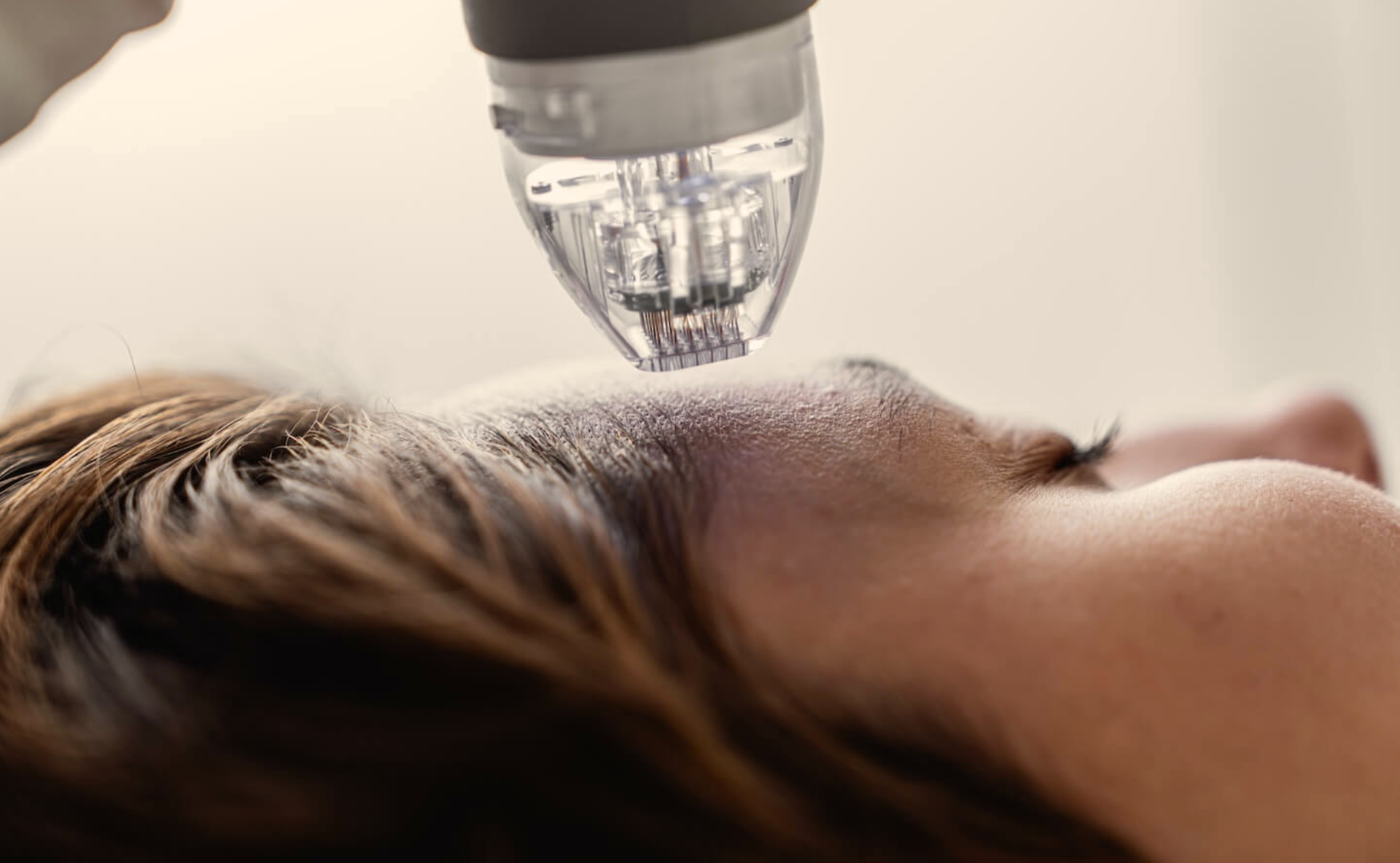 Close-up of a face with a clear facial treatment device hovering over the forehead